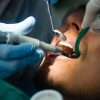 Soins dentaires : la Sécu va encore réduire la voilure…